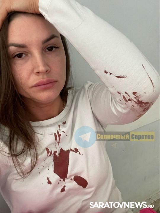 Ледяной удар по голове: в Саратове женщина пострадала от падения глыбы льда Ледяной удар по голове: в Саратове женщина пострадала от падения глыбы льда